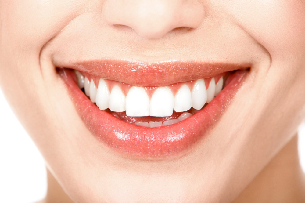 10 Consejos que no debes olvidar si quieres hacerte un blanqueamiento dental